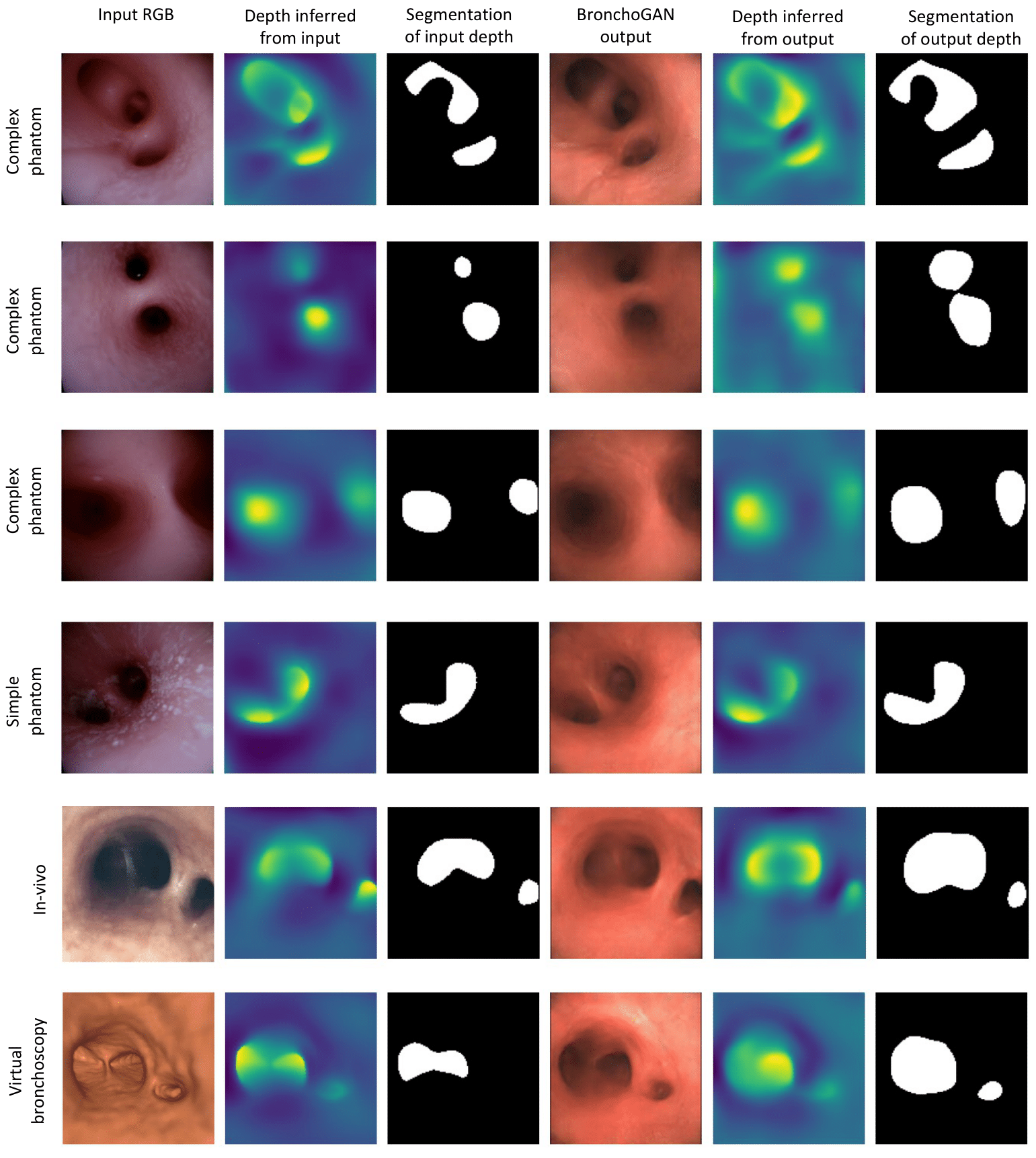 Qualitative Result 2
